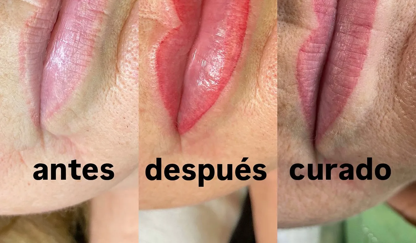 Micropigmentación de labios en tres fases: antes, recién hecha y ya curada